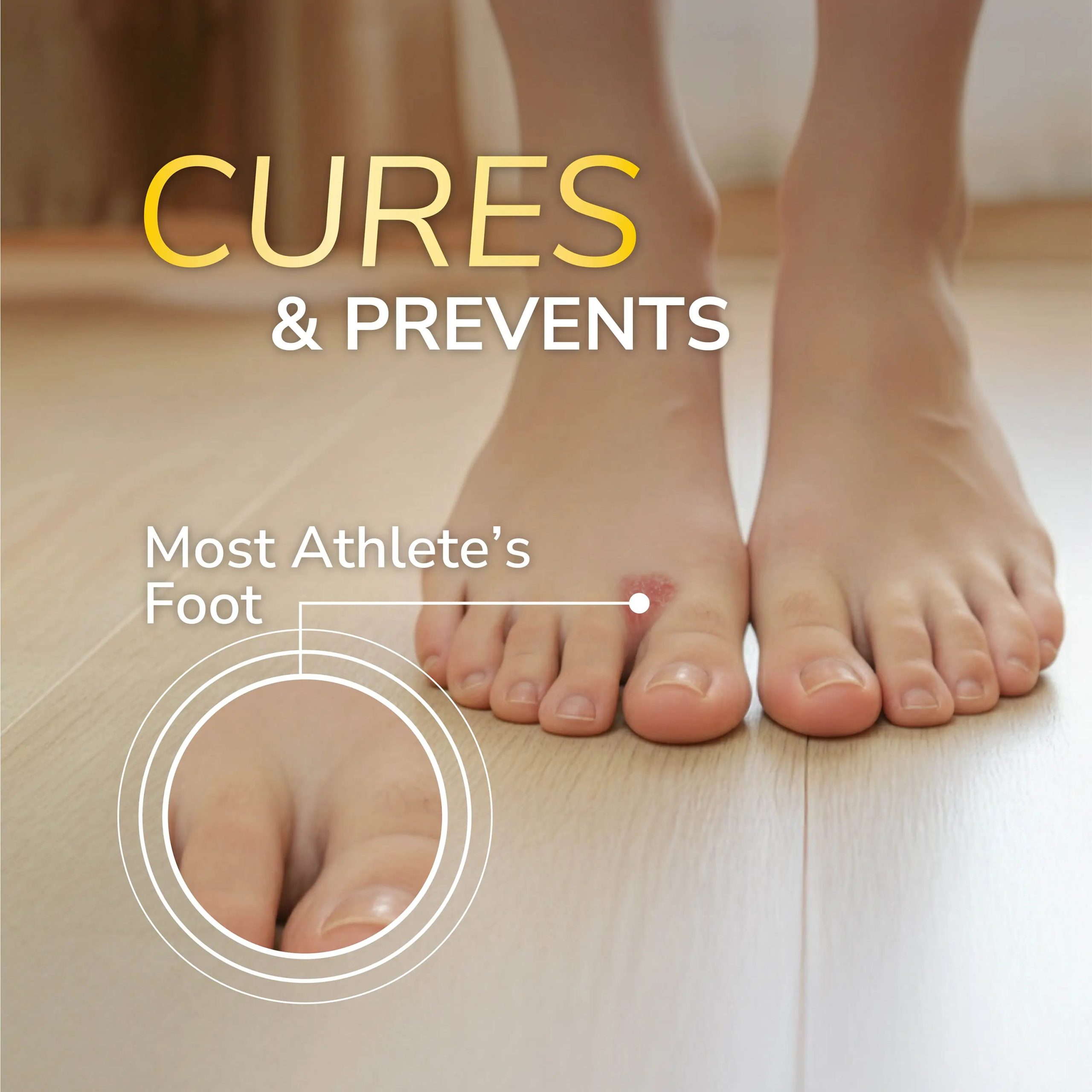 Odor-X Athlete's Foot Antifungal Cream Treatment - Image 3